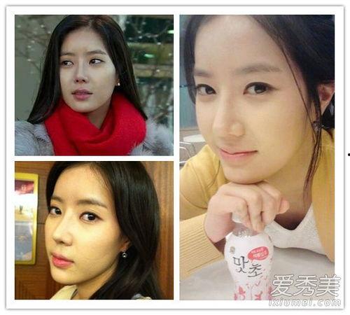 我整容照片,我的蜕变之旅